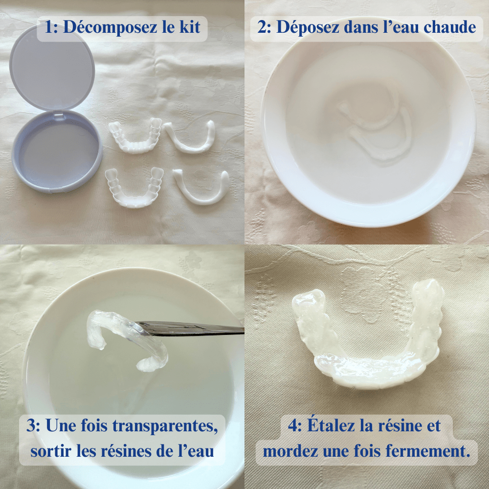 DentalFlex™ | Set de facettes modulables (haut et bas)