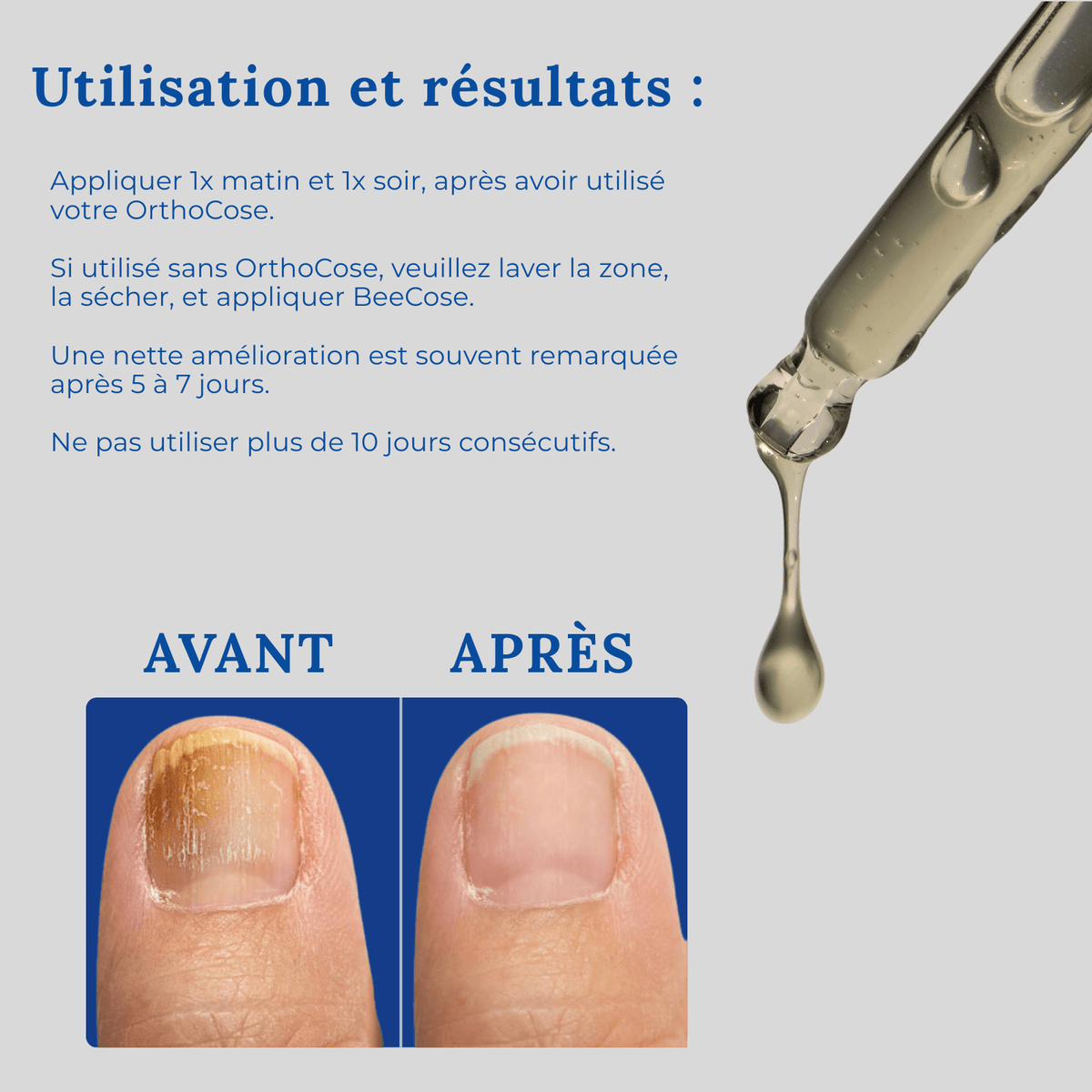 OrthoCose™ | Sérum Anti-Mycose Ongles